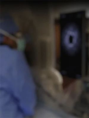 Avinger-lumivascular-hero-tablet